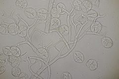 Peronospora romanica