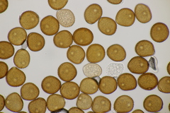 Puccinia hieracii hieracii