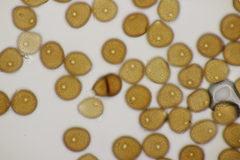 Puccinia hieracii hieracii