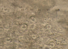 Lecanora caesiorubella caesiorubella