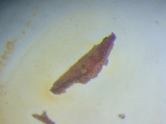 Lecanora caesiorubella caesiorubella