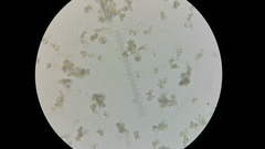 Saccharomyces cerevisiae