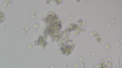 Saccharomyces cerevisiae