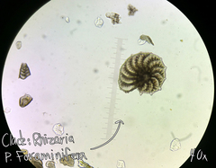 Elphidium aculeatum