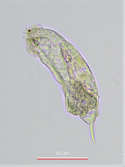 Cephalodella gracilis