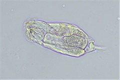 Cephalodella gracilis