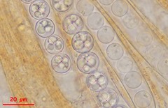 Pulvinula convexella