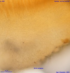 Pulvinula convexella