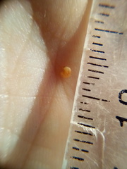 Neocyba metrosideros