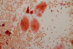 Pseudomicrostroma juglandis