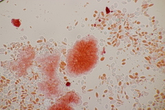 Pseudomicrostroma juglandis