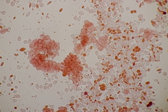 Pseudomicrostroma juglandis