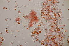 Pseudomicrostroma juglandis