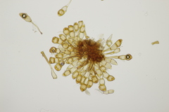 Puccinia cnici-oleracei