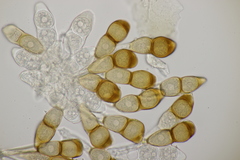 Puccinia cnici-oleracei