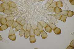 Puccinia cnici-oleracei