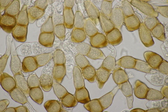 Puccinia cnici-oleracei