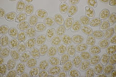 Pucciniastrum epilobii