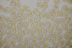 Pucciniastrum epilobii