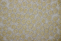 Pucciniastrum epilobii