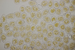 Pucciniastrum epilobii