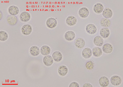 Lycogala exiguum