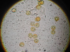 Perichaena quadrata