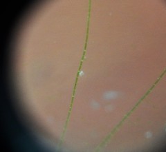 Chydorus