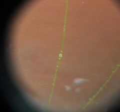 Chydorus