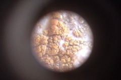 Lecanoromycetes