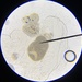 Ichthyophthirius multifiliis - Photo (c) Lexi Amico, osa oikeuksista pidätetään (CC BY), lähettänyt Lexi Amico