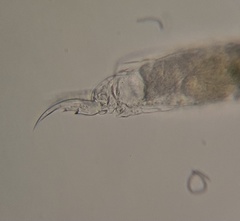 Cephalodella forficula