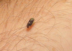 Pediopsoides distinctus