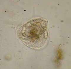 Peritrichia
