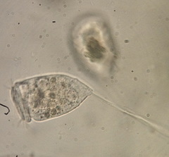 Vorticellidae