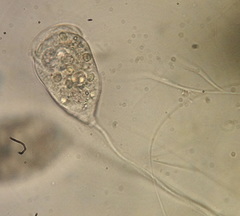 Vorticellidae