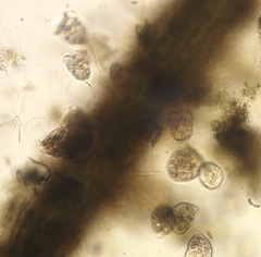 Vorticellidae