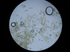 Apatococcus