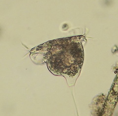 Vorticella