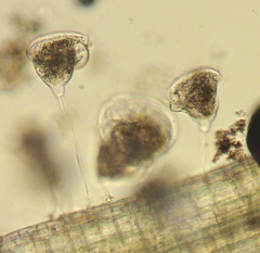Vorticella