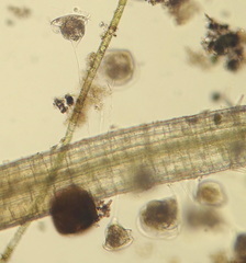 Vorticella