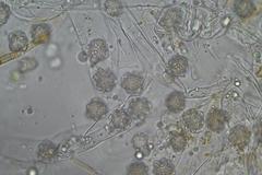 Octospora maireana