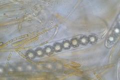 Octospora maireana