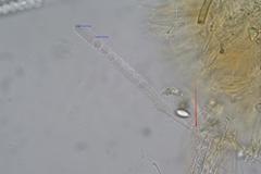 Pulvinula archeri