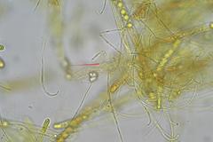 Pulvinula archeri