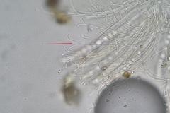 Pulvinula archeri