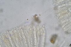 Pulvinula archeri
