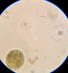 Ophryoglena