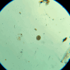 Ophryoglena