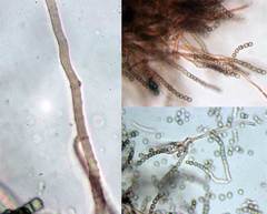 Coremiella cubispora